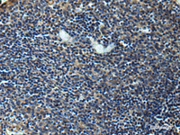 Immunohistochemistry of paraffin-embedded Human tonsil tissue using ERLIN1 Polyclonal Antibody at dilution of 1:50 (×200)