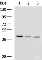 Western blot analysis of Human cerebrum tissue Human cerebella tissue Mouse brain tissue lysates using ENKD1 Polyclonal Antibody at dilution of 1:1150