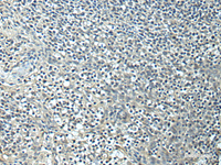 Immunohistochemistry of paraffin-embedded Human tonsil tissue using SLC35F6 Polyclonal Antibody at dilution of 1:95 (×200)