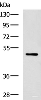 Western blot analysis of MCF-7 cell lysate using PAX2 Polyclonal Antibody at dilution of 1:400