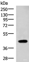 Western blot analysis of Raji cell lysate using ADH1B Polyclonal Antibody at dilution of 1:1000