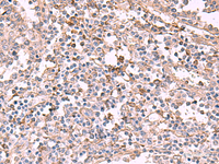 Immunohistochemistry of paraffin-embedded Human tonsil tissue using ADH1B Polyclonal Antibody at dilution of 1:55 (×200)