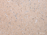 Immunohistochemistry of paraffin-embedded Human brain tissue using DEFB112 Polyclonal Antibody at dilution of 1:40 (×200)