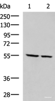 Western blot analysis of LOVO and LO2 cell lysates using ECM1 Polyclonal Antibody at dilution of 1:650