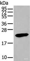 Western blot analysis of Human stomach tissue lysate using GKN1 Polyclonal Antibody at dilution of 1:250