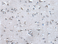 Immunohistochemistry of paraffin-embedded Human brain tissue using HAND1 Polyclonal Antibody at dilution of 1:30 (×200)