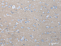 Immunohistochemistry of paraffin-embedded Human brain tissue using ETFB Polyclonal Antibody at dilution of 1:40 (×200)