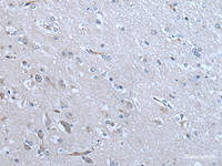 Immunohistochemistry of paraffin-embedded Human brain tissue using ZC3HAV1 Polyclonal Antibody at dilution of 1:70 (×200)