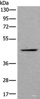 Western blot analysis of Human fetal liver tissue lysate using BMP2 Polyclonal Antibody at dilution of 1:800