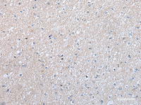 Immunohistochemistry of paraffin-embedded Human brain tissue using ENPP2 Polyclonal Antibody at dilution of 1:50 (×200)