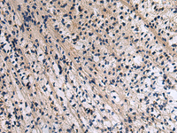 Immunohistochemistry of paraffin-embedded Human brain tissue using CD274 Polyclonal Antibody at dilution of 1:30 (×200)