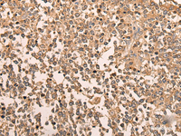 Immunohistochemistry of paraffin-embedded Human tonsil tissue using LDAH Polyclonal Antibody at dilution of 1:70 (×200)