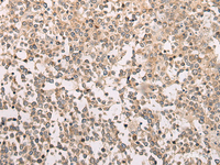 Immunohistochemistry of paraffin-embedded Human tonsil tissue using M1AP Polyclonal Antibody at dilution of 1:80 (×200)