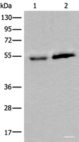 Western blot analysis of Human fetal intestines tissue and Human breast cancer tissue lysates using CCDC85C Polyclonal Antibody at dilution of 1:400