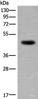 Western blot analysis of Human heart tissue lysate using CDKL4 Polyclonal Antibody at dilution of 1:350