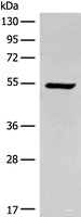 Western blot analysis of HEPG2 cell lysate using ACD Polyclonal Antibody at dilution of 1:400