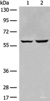 Western blot analysis of HEPG2 and Jurkat cell lysates using EBF2 Polyclonal Antibody at dilution of 1:650