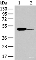 Western blot analysis of Mouse heart tissue and K562 cell lysates using ACOD1 Polyclonal Antibody at dilution of 1:400