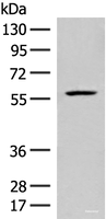 Western blot analysis of Mouse liver tissue lysate using FKTN Polyclonal Antibody at dilution of 1:450