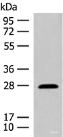 Western blot analysis of Mouse eye tissue lysate using GUCA1B Polyclonal Antibody at dilution of 1:500