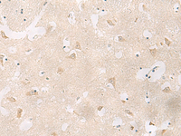 Immunohistochemistry of paraffin-embedded Human brain tissue using GPR83 Polyclonal Antibody at dilution of 1:60 (×200)