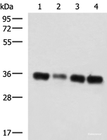 Western blot analysis of 293T cell lysates using GRHPR Polyclonal Antibody at dilution of 1:750