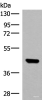 Western blot analysis of TM4 cell lysate using GTF3A Polyclonal Antibody at dilution of 1:550