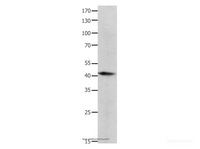 Western Blot analysis of Human lymphoma tissue using BMP4 Polyclonal Antibody at dilution of 1:350