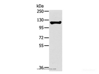 Western Blot analysis of Human fetal liver tissue using TERT Polyclonal Antibody at dilution of 1:200