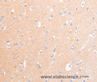 Immunohistochemistry of paraffin-embedded Human brain tissue using CD56 Polyclonal Antibody at dilution 1:30