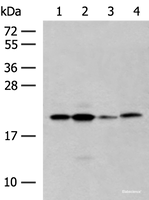 Western blot analysis of 293T cell lysates using RNF5 Polyclonal Antibody at dilution of 1:250