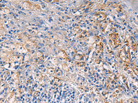 Immunohistochemistry of paraffin-embedded Human brain tissue using NFKB1 Polyclonal Antibody at dilution of 1:80 (×200)