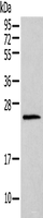 Western blot analysis of Mouse lung tissue using HIST1H1T Polyclonal Antibody at dilution of 1:400
