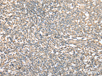 Immunohistochemistry of paraffin-embedded Human tonsil tissue using CD1D Polyclonal Antibody at dilution of 1:25 (×200)