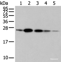 Western blot analysis of 293T A549 and 231 cell Human fetal brain tissue Human placenta tissue using RAB11A Polyclonal Antibody at dilution of 1:500