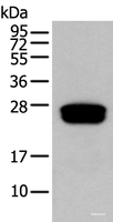 Western blot analysis of Human testis tissue using GLIPR1L1 Polyclonal Antibody at dilution of 1:300