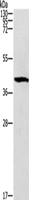 Western blot analysis of Mouse brain tissue using ZADH2 Polyclonal Antibody at dilution of 1:1000