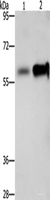 Western blot analysis of Hepg2 cells NIH/3T3 cells using ZBTB7A Polyclonal Antibody at dilution of 1:500