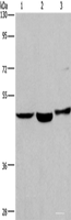 Western blot analysis of Human placenta tissue Human fetal liver tissue 231 cells using APMAP Polyclonal Antibody at dilution of 1:400