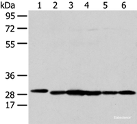 Western blot analysis of 293T HepG2 K562 and MCF-7 cell using PRDX4 Polyclonal Antibody at dilution of 1:300