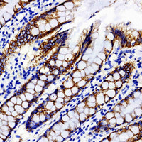 Immunohistochemistry analysis of paraffin-embedded Human colon tissue using Catenin beta Polyclonal Antibody at dilution of 1:300.