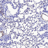 Immunohistochemistry analysis of paraffin-embedded mouse lung cancer using CD31 Polyclonal Antibody at dilution of 1:300.