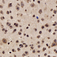 Immunohistochemistry analysis of paraffin-embedded mouse brain using GSK3 beta Polyclonal Antibody at dilution of 1:300.