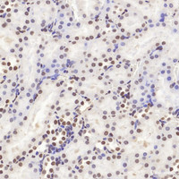 Immunohistochemistry analysis of paraffin-embedded mouse kidney using HMGB1 Polyclonal Antibody at dilution of 1:500.