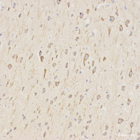Immunohistochemistry analysis of paraffin-embedded rat brain using LC3A/B Polyclonal Antibody at dilution of 1:500.