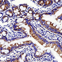 Immunohistochemistry analysis of paraffin-embedded rat colon using MMP2 Polyclonal Antibody at dilution of 1:500.