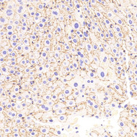 Immunohistochemistry analysis of paraffin-embedded Mouse liver using N-cadherin Polyclonal Antibody at dilution of 1:500.