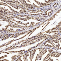 Immunohistochemistry analysis of paraffin-embedded human stomach using PTEN Polyclonal Antibody at dilution of 1:200.