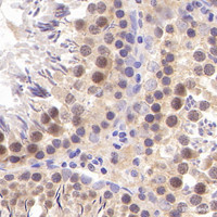 Immunohistochemistry analysis of paraffin-embedded Rat testis using SIRT1 Polyclonal Antibody at dilution of 1:300.