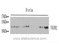 Western Blot analysis of various samples using FLK1 Polyclonal Antibody at dilution of 1:800.